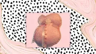 Baby Roze Gipsbuik met Kant