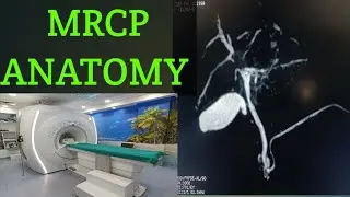 MRCP ANATOMY step by step #Mrcp anatomy #Mrcp #3D Mrcp Anatomy
