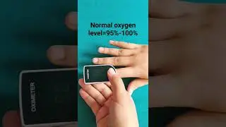 pulse oximeter use#shorts #viral