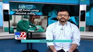 Varicose Veins - Symptoms and Causes by Dr Raja V Koppala  | Avis Hospitals