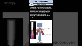 Side Lobe Artifact