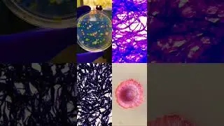 #microbiology #youtubeshorts #shortvideo #video #shorts #viral #shortsfeed #labs #fungus #bacteria