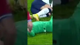 Cristiano Ronaldo nose broken injury #shorts #viralshort