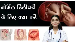 नॉर्मल डिलीवरी चाहती हैं? तो ये है आसान उपाय | Tips for Normal Delivery in Hindi skmedicine 