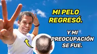 &iquest;CONOC&Iacute;AS EL PODER DE LAS C&Eacute;LULAS MADRE DE C&Uacute;RCUMA PARA EL CABELLO? | IVAN LALINDE