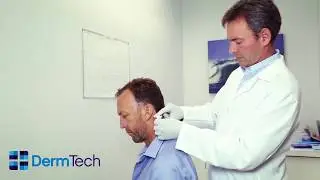 DermTech Instructions for use