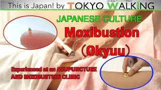 [This is Japan!] Okyuu at an ACUPUNCTURE AND MOXIBUSTION CLINIC