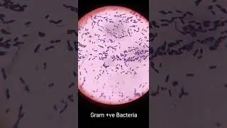 Gram Staining Results #biology #explore #science #experiment