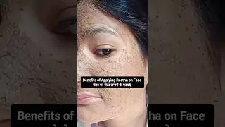 Benefits of Reetha Powder for Face #naturalrahat #skincare #shorts