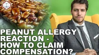 Peanut Allergy Reaction &ndash; How To Claim Compensation? ( 2019 ) UK