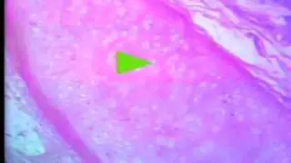 Survey of Microscopic Anatomy- Cartilage