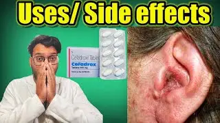 Cefadrox Tablet uses , Anti Bacterial Medicine, infection like throat , ear , uti , skin infection