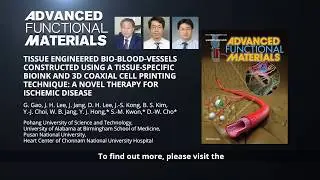 Tissue Engineered Bio-Blood-Vessels: A Novel Therapy for Ischemic Disease