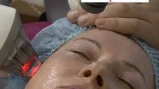 Лечение лазером 