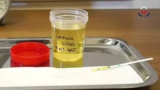 Correcto modo de realizar an&aacute;lisis de orina usando tiras reactivas
