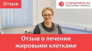 Отзыв о лечении жировыми клетками (SVF-терапия)