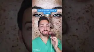 Skin things (14) #dermatologist #dermdoctor #skincare #sunscreen #freckles #DermDoctor #short