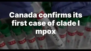 Canada's First Clade I Mpox Case 2024: What You Need to Know