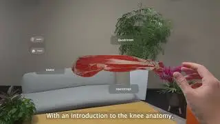 MediView