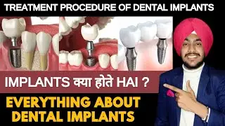 What are Dental Implants | Complete Procedure | Post Operative Instructions After Implants