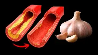 Das beste Rezept zur Reinigung der Arterien! Ideal f&uuml;r die Durchblutung