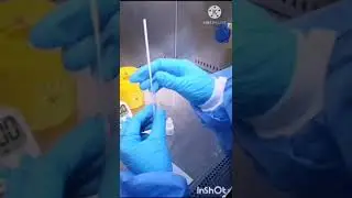 Accu Tell test r&aacute;pido SARS CoV 2 Antigen Rapid Test Video 1
