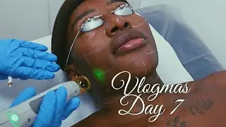 VLOGMAS DAY 7 - Christmas Shopping + Laser Hair Removal + OOTD |ThePlasticboy