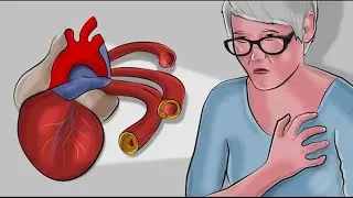 Die besten natürlichen Mittel, um verstopfte Arterien zu reinigen!