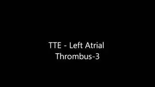 Left Atrial Thrombus - Transthoracic Echocardiogram (TTE)