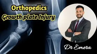 Growth Plate injury 