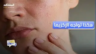 3 نصائح فعالة لتفادي الإكزيما في الشتاء - دردشات