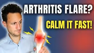 How to Calm an Osteoarthritis Flare-Up Fast (Do This First)