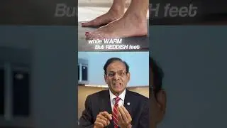 What Your Foot Temperature Says About Blood Circulation