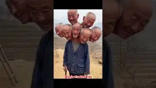 Tasbih song conjoined twins head omg#godblessyou#shorts#viralshort#tiktokviral
