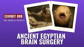 Ancient Egyptians Performed Brain Surgery 3,000 Years Before Europe | Exhibit #008