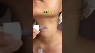 1 Serum to Fade Fine Lines &ndash; My Secret&rsquo;s Out! ✨ | Click the Link 👇
