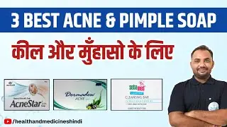 कील और मुहांसों के लिए बेस्ट 3 साबुन | 3 Best Soaps For Acne & Pimples (In Hindi)