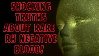 Shocking Truths about Rare RH Negative Blood