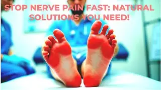 Stop Nerve Pain Fast: Natural Solutions You Need!