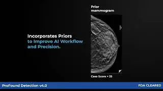 ProFound Detection V4 - FDA Cleared, Next Generation AI-powered Mammography.