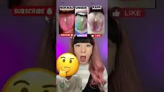 Normal vs Rare vs Unique! | Only One Option Challenge! 🔥
