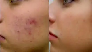 Remove Dead Skin Effortlessly in Just 60 seconds with CTFO Exfoliator