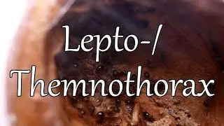 Walnussnest Baututorial!!  -  Neue Lepto-/Themnothoraxkolonie ;D