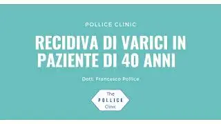 Recidiva di varici in pazienti di 40 anni