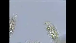 Pantoffeltierchen (Paramecium) unter dem Mikroskop