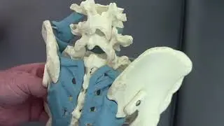 How Treatment of the Pubic Joints AKA Symphysis Pubis Helps the Sacroiliac Joint Part 1 of 3