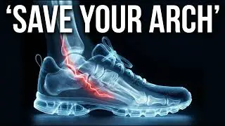 The 'Flat Foot' Injury: Stop Your Arch From Collapsing