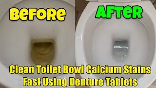 🚽 How to Remove Toilet Bowl Calcium Stains with Denture Tablets & Make It Shine ✨