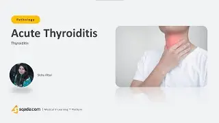 Thyroiditis | Acute Thyroiditis