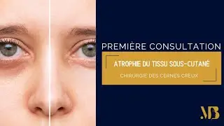 Première consultation : Traitement des cernes creux (regard fatigué)